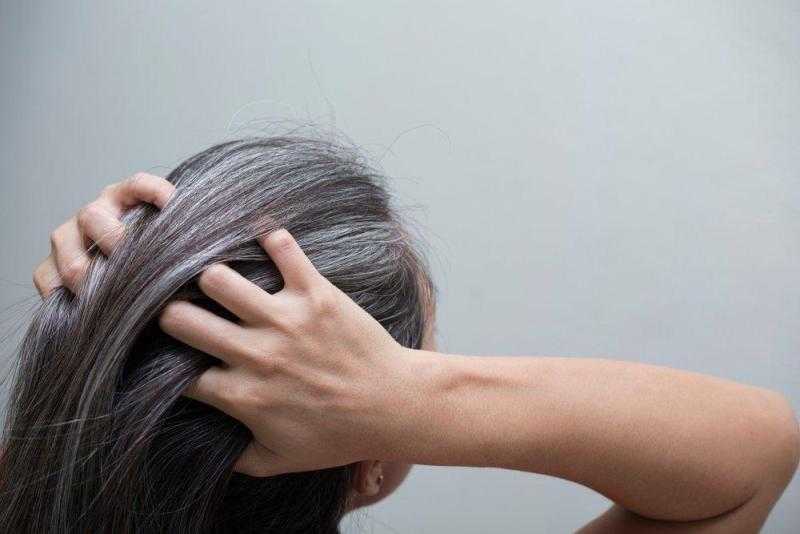 وصفات طبيعية للتخلص من شيب الشعر