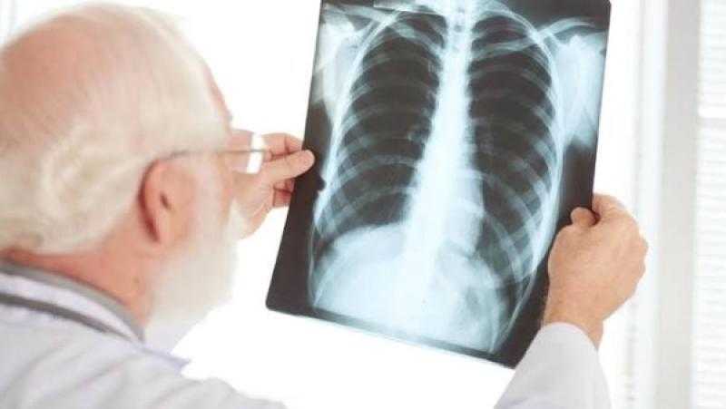 هل تسبب بخاخات الصدر الإدمان؟.. طبيب يوضح بالفيديو