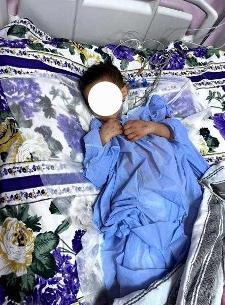 فريق طبي بمستشفيات جامعة سوهاج ينجح في إنقاذ حياة طفل عقب تعرضه لحادث مروع