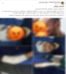 الداخلية تكشف حقيقة إدعاء فني تمريض تعرضه للاعتداء بسلاح أبيض داخل مستشفى بالإسماعيلية
