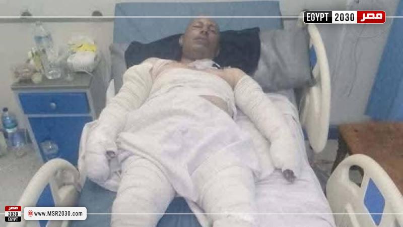 وفاة بطل «سيارة البنزين»
