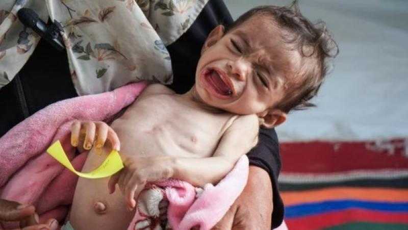 مثير للاشمئزاز.. جيمس إلدر يحذر من كارثة في غزة وموت جماعي