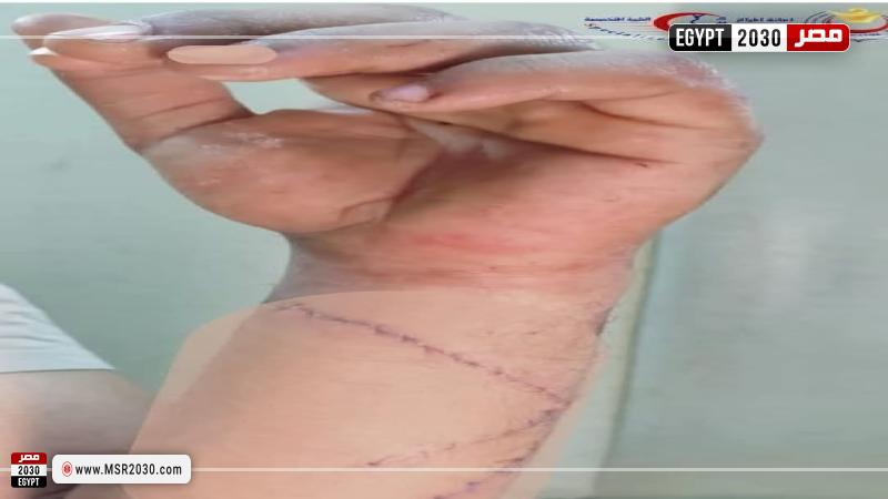 مستشفى جراحات اليوم الواحد البساتين
