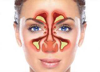 علاجات منزليه للجيوب الأنفية