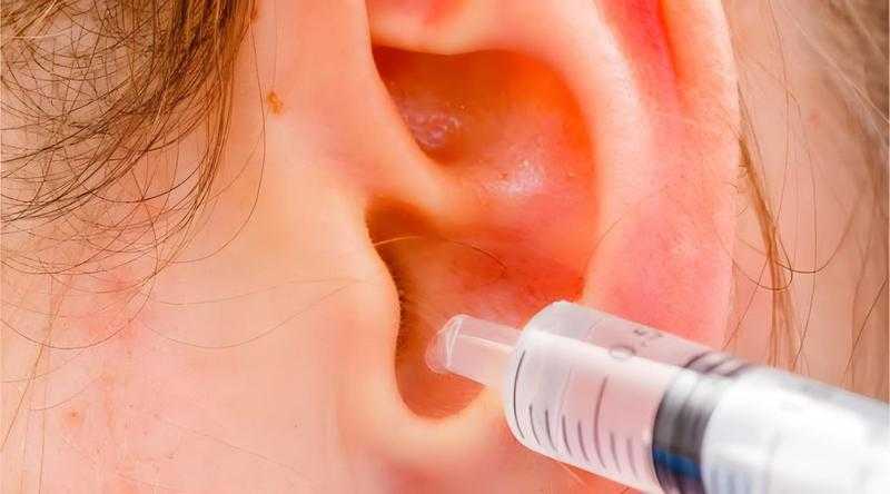 تنظيف الأذن في المنزل بطريقة آمنة.. تفاصيل