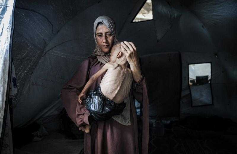 كارثة إنسانية في غزة: 40 ألف رضيع مهددون بالموت
