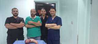 صحة الشرقية: إجراء أول عملية تكميم معدة بالمنظار بمستشفى ديرب نجم المركزي