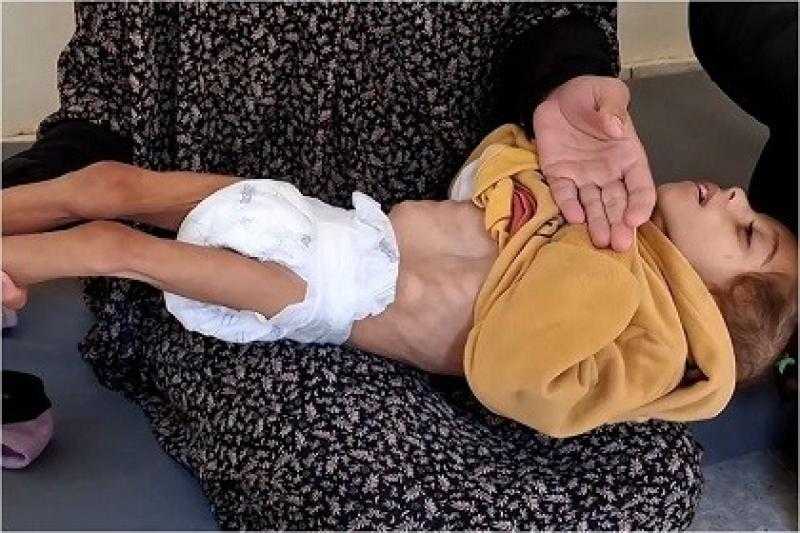 طبيب أمريكي متطوع بقطاع غزة: الأطفال يجب ألا يكونوا جزءا من الحروب
