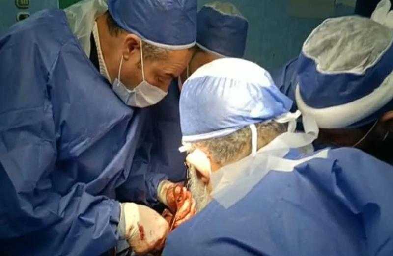 إنقاذ حياة رضيع بعملية جراحية نادرة في مصر القديمة