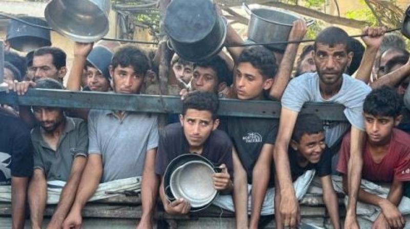 اليونيسف: غزة أصبحت مقبرة الأطفال.. 26 ألف طفل فلسطيني مصابون بسوء التغذية الحاد