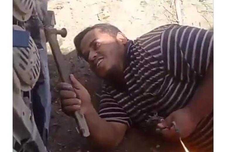 «طبيب الكفاح» من ورشة السمكرة إلى مدرجات الطب.. قصة شاب هزم الواقع بالإرادة