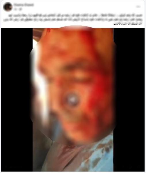 الأمن يكشف ملابسات مشاجرة والتعدي على أحد الأشخاص إثر خلافات سابقة بالدقهلية