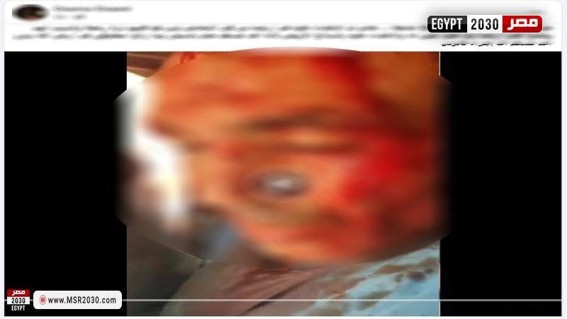 المجني عليه 