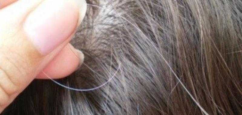 أسباب الشيب المبكر.. تفاصيل