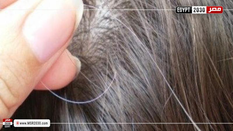 الشيب المبكر 