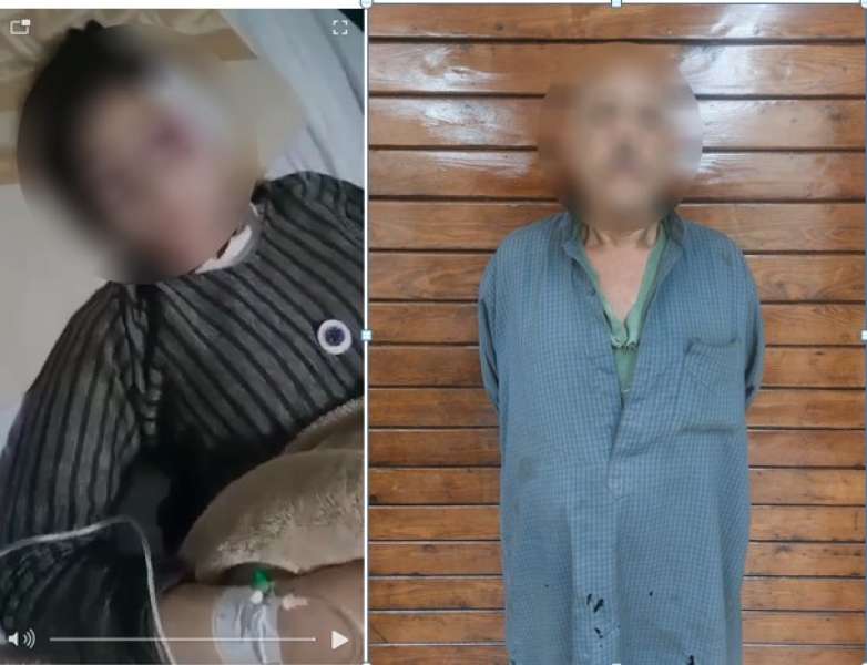 ضبط أب بعد إلقاء ابنته من شرفة منزلها 