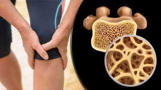 تعرف على أسباب نقص فيتامين د تعرف على أسباب نقص فيتامين د