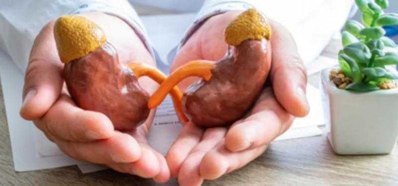 أسباب الإصابة بالفشل الكلوي.. تفاصيل