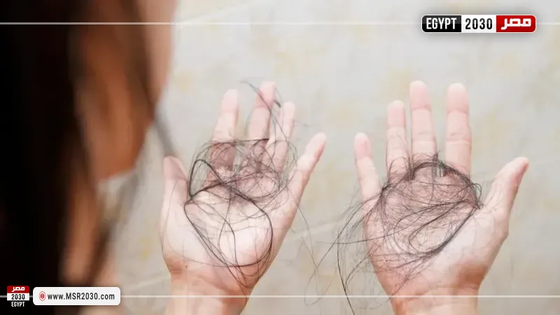 تساقط الشعر 