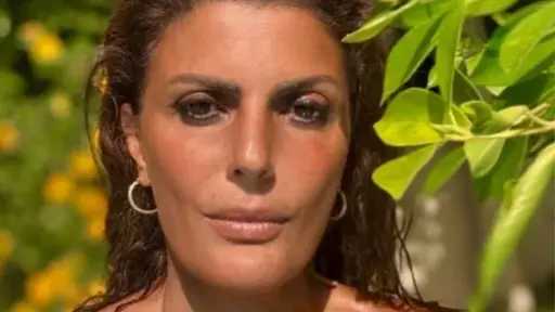 فيدرا تثير الجدل: أصحاب الحيوانات الأليفة يواجهون صعوبة في تقبل مصاريف رعايتها