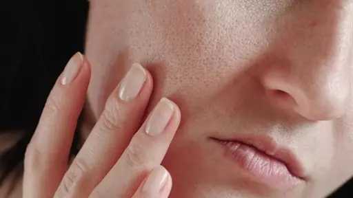 علاج البشرة الجافة.. تفاصيل علاج البشرة الجافة.. تفاصيل