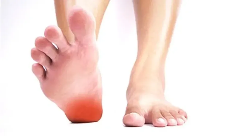 الشوكة العظمية 