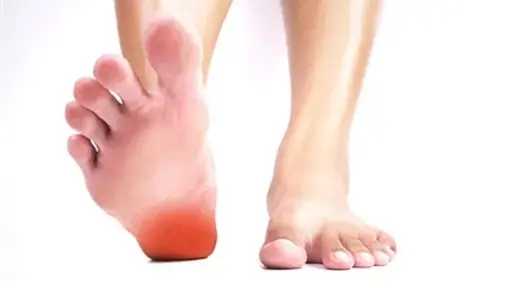 طرق فعالة لعلاج ألم الشوكة العظمية