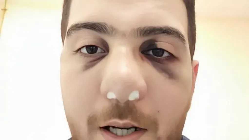 واقعة مستشفى الباجور.. فيديو يوثق اعتداء الطبيب أولا على مرافق المريض