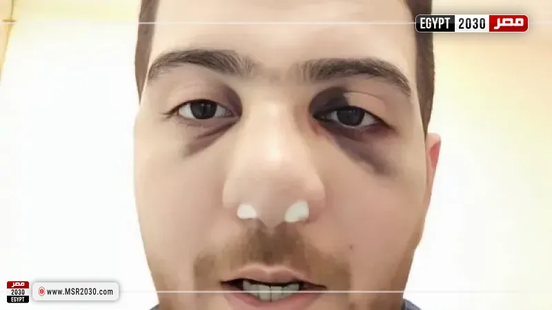 واقعة مستشفى الباجور