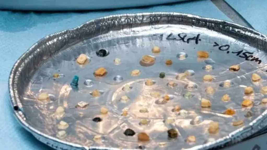 تلوث البلاستيك يضرب سواحل الأطلسي الجنوبية في المغرب