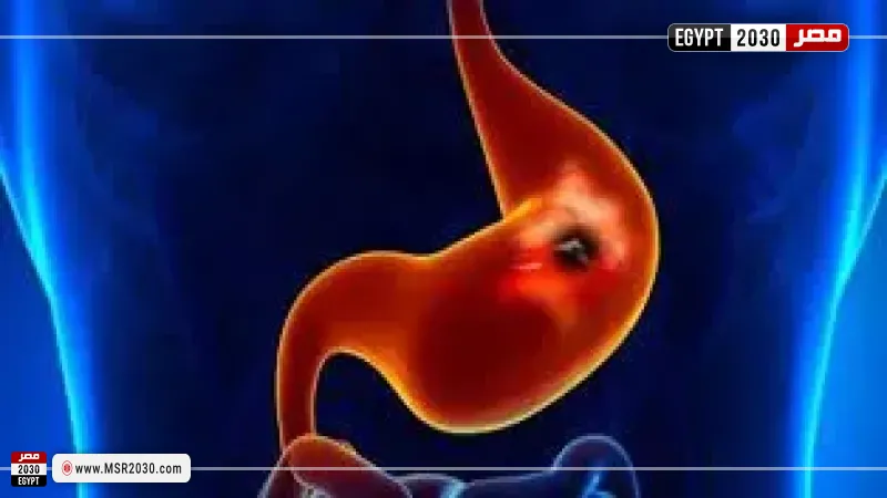 مصر 2030