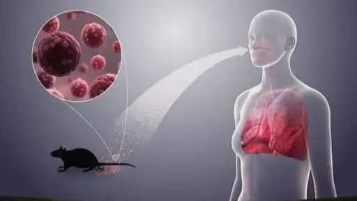 فيروس هانتا.. كيف ينتقل وما مدى خطورته؟