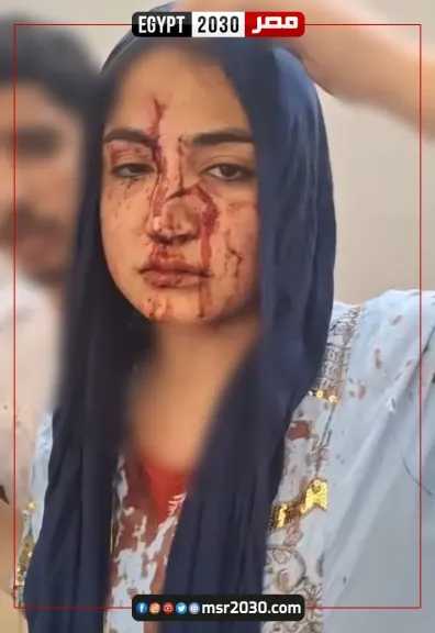 لمطالبتها بحقوقها الشرعية.. طليق ينهال بالضرب على زوجته السابقة وأسرتها في القليوبية