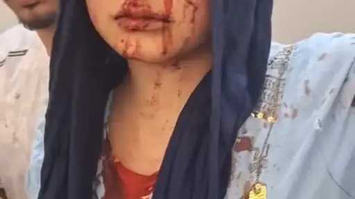 لمطالبتها بحقوقها الشرعية.. طليق ينهال بالضرب على زوجته السابقة وأسرتها في القليوبية