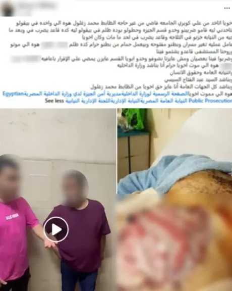 الداخلية: صورة متهم متوفى داخل قسم شرطة بالجيزة تعود لعملية جراحية قبل 3 سنوات