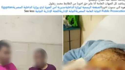 الداخلية: صورة متهم متوفى داخل قسم شرطة بالجيزة تعود لعملية جراحية قبل 3 سنوات
