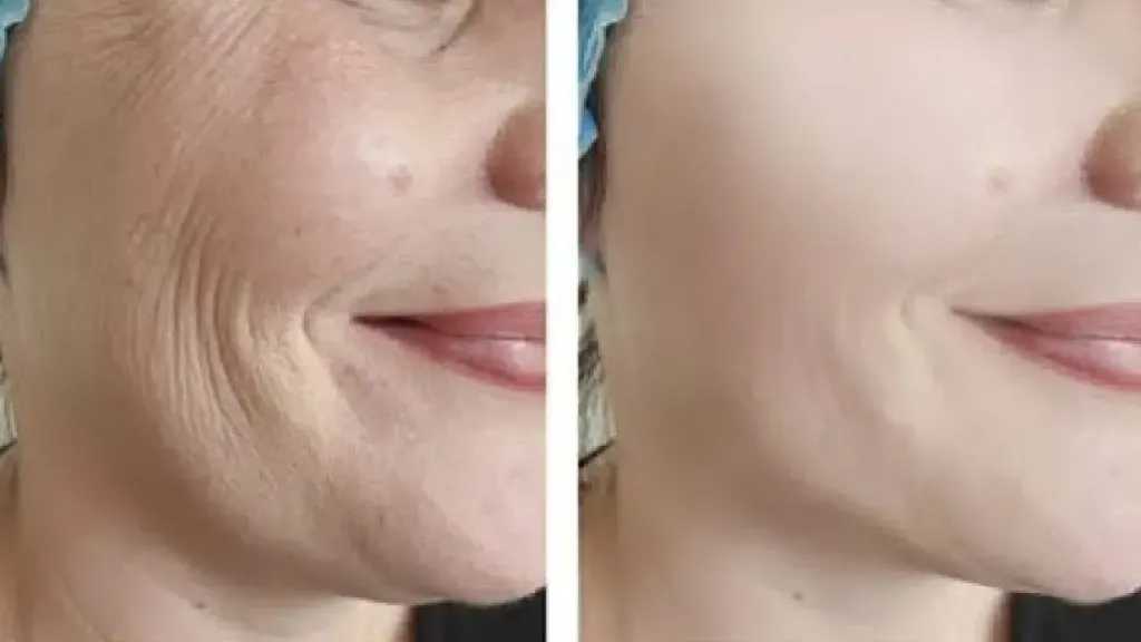 طرق فعالة للحد من تجاعيد الوجه وعلامات الشيخوخة المبكرة
