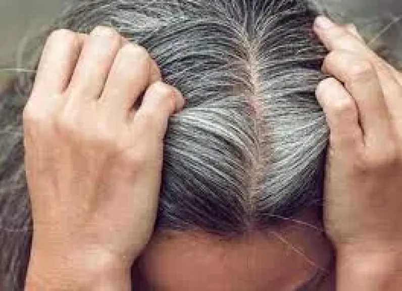 أسباب ظهور الشيب.. وهل يمكن استعادة لون الشعر الطبيعي؟