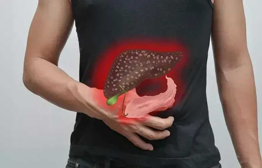 أعراض تليف الكبد.. تفاصيل