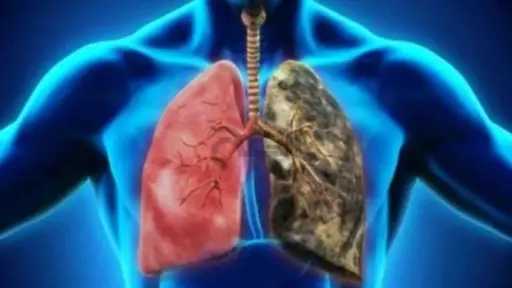 مريض تليف الرئة.. 7 أطعمة يفضل تقليلها مريض تليف الرئة.. 7 أطعمة يفضل تقليلها