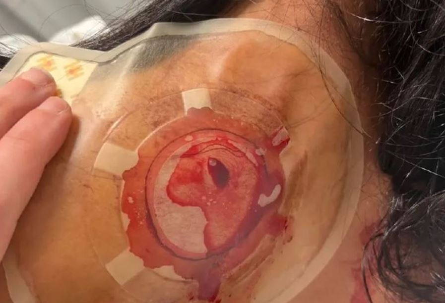 طعن غدير الفهد